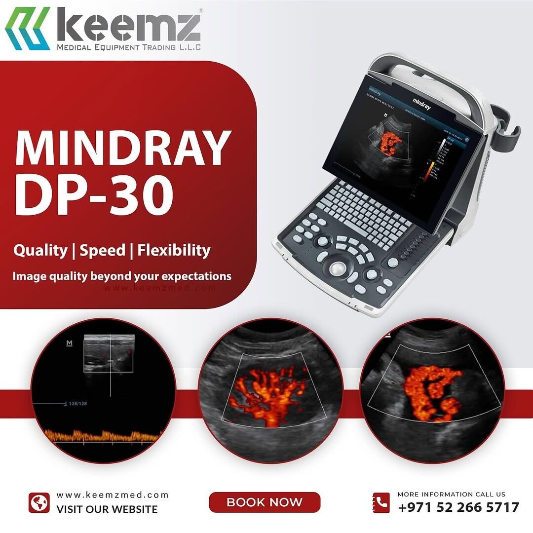 Mindray DP-30 ultrasound